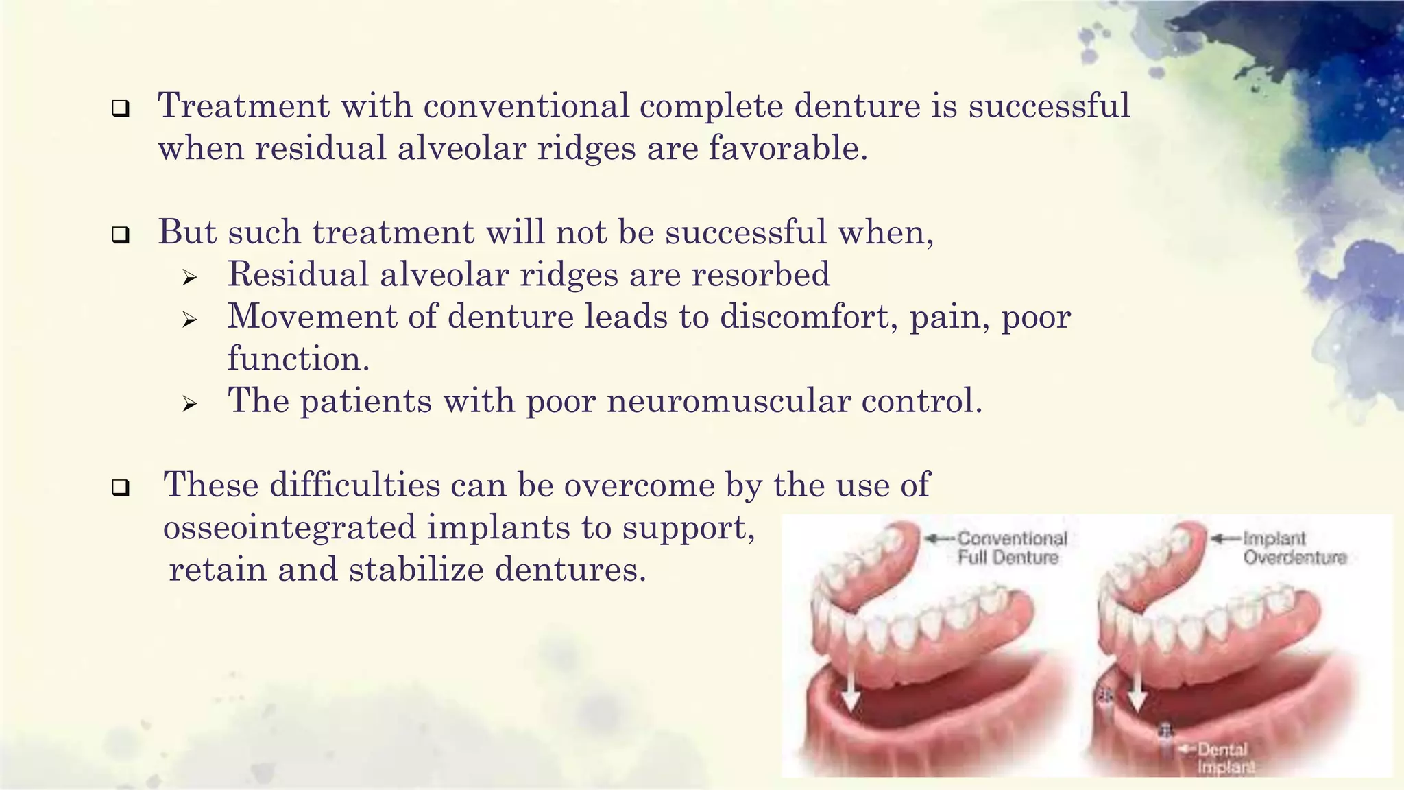 Implant supported overdenture | PPTX