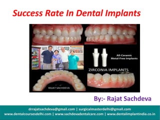Success Rate In Dental Implants
By:- Rajat Sachdeva
 