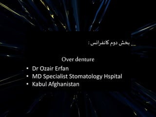 ‫انس‬‫ر‬‫کانف‬ ‫دوم‬ ‫بخش‬:
Over denture
• Dr Ozair Erfan
• MD Specialist Stomatology Hspital
• Kabul Afghanistan
 