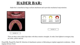 implant supported overdenture by Dr kavan doshi | PPTX