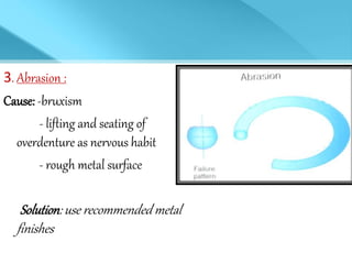 3. Abrasion :
Cause: -bruxism
- lifting and seating of
overdenture as nervous habit
- rough metal surface
Solution: use recommended metal
finishes
 