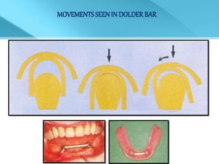MOVEMENTSSEENIN DOLDERBAR
 