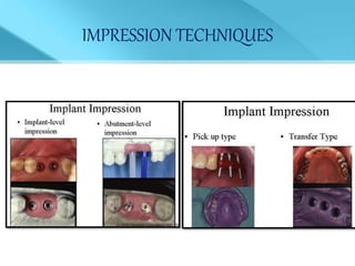 IMPRESSION TECHNIQUES
 