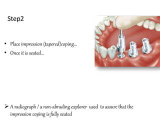 Step2
• Place impression (tapered)coping…
• Once it is seated…
 A radiograph / a non-abrading explorer used to assure that the
impression coping is fully seated.
 