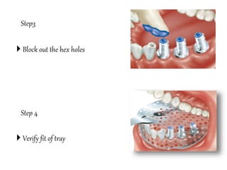 Step3
 Block out the hex holes
Step 4
 Verify fit of tray
 