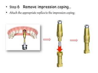 • Step 6 Remove impression coping…
• Attach the appropriate replica to the impression coping.
 