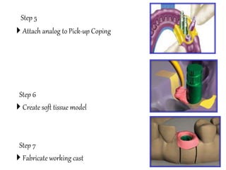 Step 5
 Attach analog to Pick-up Coping
Step 6
 Create soft tissue model
Step 7
 Fabricate working cast
 