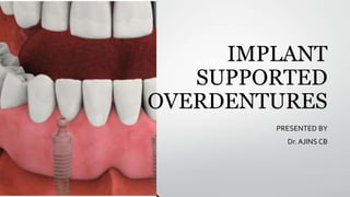 IMPLANT
SUPPORTED
OVERDENTURES
PRESENTED BY
Dr. AJINS CB
 