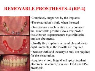 REMOVABLE PROSTHESES-4 (RP-4)
•Completely supported by the implants
•The restoration is rigid when inserted
•Overdenture attachments usually connect
the removable prosthesis to a low-profile
tissue bar or superstructure that splints the
implant abutments.
•Usually five implants in mandible and six to
eight implants in the maxilla are required.
•Denture teeth and the acrylic bulk are required
for the restoration.
•Requires a more lingual and apical implant
placement in comparison with FP-1 and FP-2
prosthesis.
 