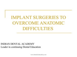 IMPLANT SURGERIES TO
OVERCOME ANATOMIC
DIFFICULTIES
INDIAN DENTAL ACADEMY
Leader in continuing Dental Education
www.indiandentalacademy.com
 