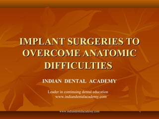 IMPLANT SURGERIES TOIMPLANT SURGERIES TO
OVERCOME ANATOMICOVERCOME ANATOMIC
DIFFICULTIESDIFFICULTIES
INDIAN DENTAL ACADEMY
Leader in continuing dental education
www.indiandentalacademy.com
www.indiandentalacademy.comwww.indiandentalacademy.com
 
