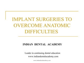 IMPLANT SURGERIES TO
OVERCOME ANATOMIC
DIFFICULTIES
INDIAN DENTAL ACADEMY
Leader in continuing dental education
www.indiandentalacademy.com
www.indiandentalacademy.com
 