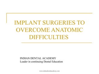 IMPLANT SURGERIES TO
OVERCOME ANATOMIC
DIFFICULTIES
INDIAN DENTAL ACADEMY
Leader in continuing Dental Education
www.indiandentalacademy.com
 