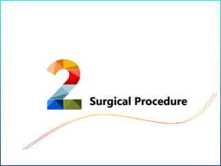 Surgical Procedure
 