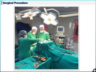 13
Surgical Procedure
 