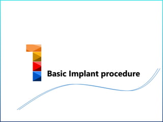 Basic Implant procedure
 