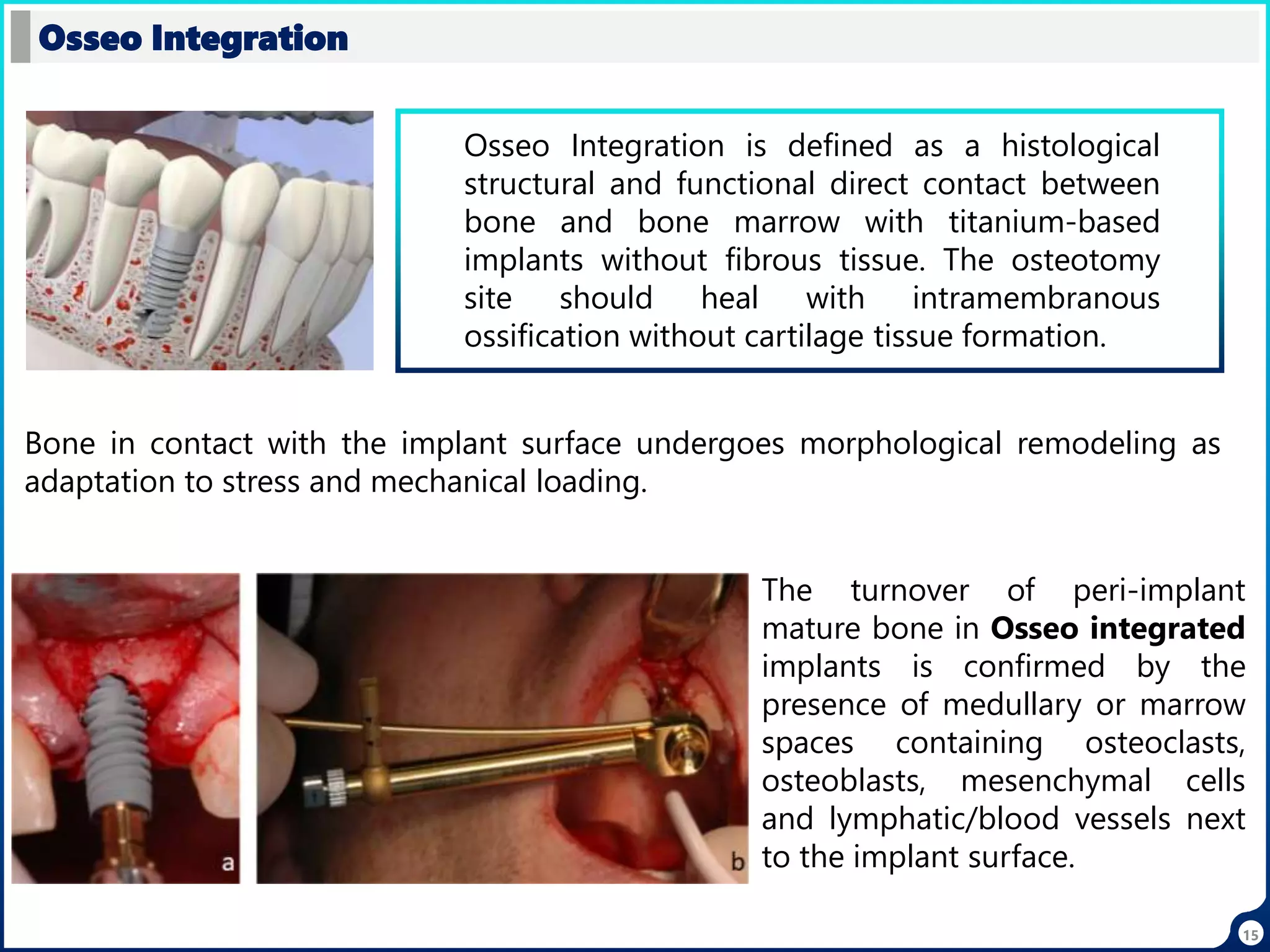 15
Osseo Integration
Osseo Integration is defined as a histological
structural and functional direct contact between
bone and bone marrow with titanium-based
implants without fibrous tissue. The osteotomy
site should heal with intramembranous
ossification without cartilage tissue formation.
Bone in contact with the implant surface undergoes morphological remodeling as
adaptation to stress and mechanical loading.
The turnover of peri-implant
mature bone in Osseo integrated
implants is confirmed by the
presence of medullary or marrow
spaces containing osteoclasts,
osteoblasts, mesenchymal cells
and lymphatic/blood vessels next
to the implant surface.
 