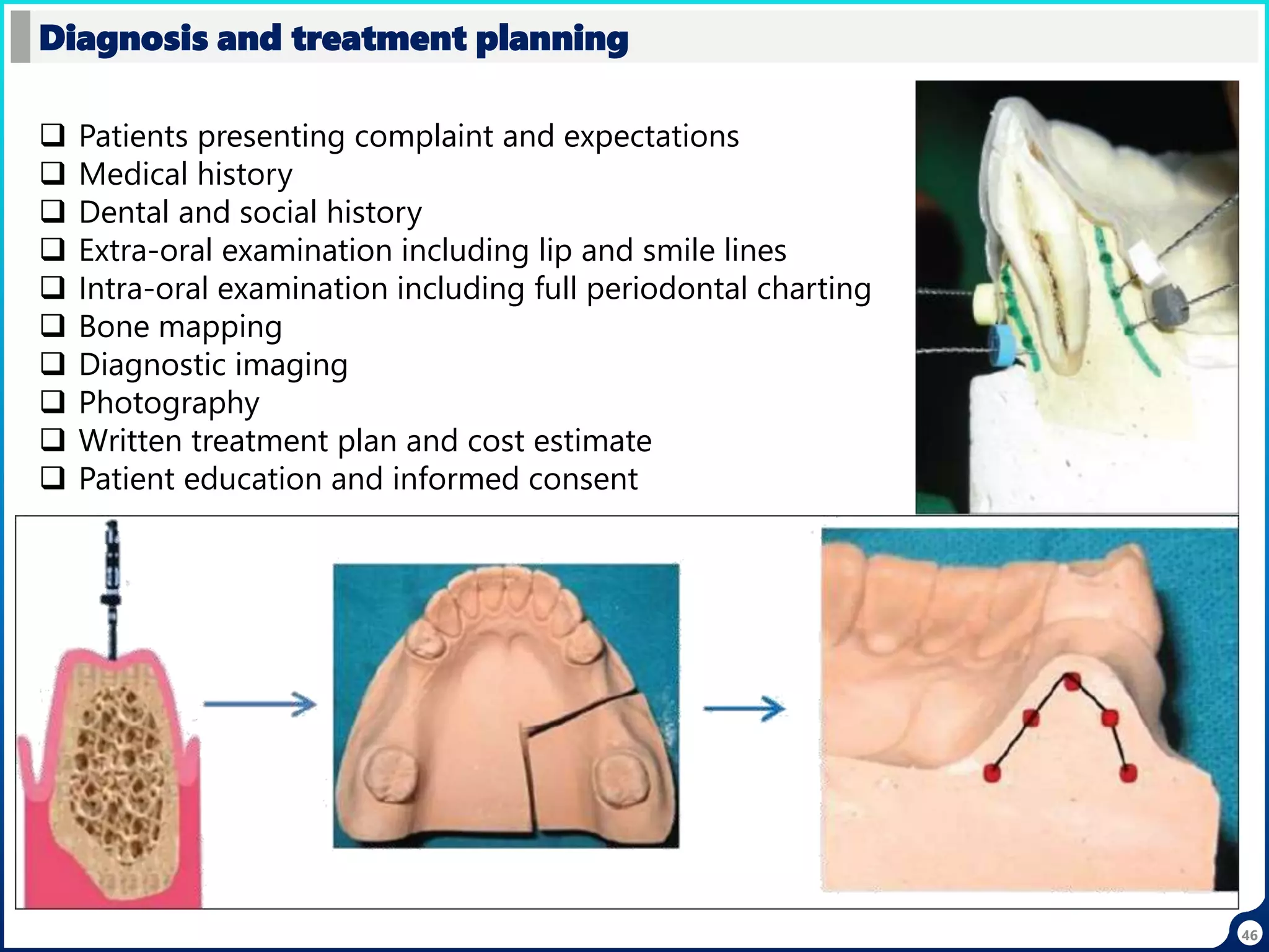 46
Diagnosis and treatment planning
 Patients presenting complaint and expectations
 Medical history
 Dental and social history
 Extra-oral examination including lip and smile lines
 Intra-oral examination including full periodontal charting
 Bone mapping
 Diagnostic imaging
 Photography
 Written treatment plan and cost estimate
 Patient education and informed consent
 