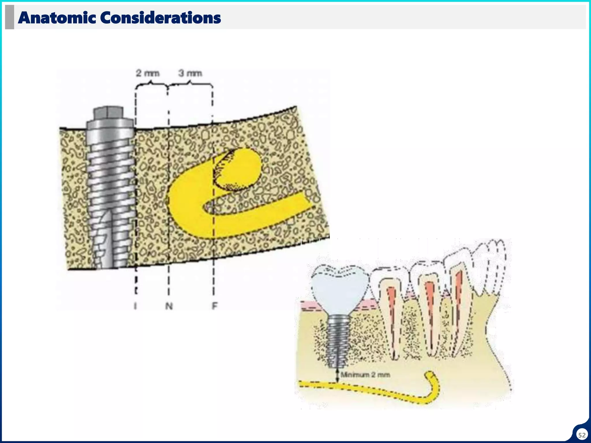 52
Anatomic Considerations
 