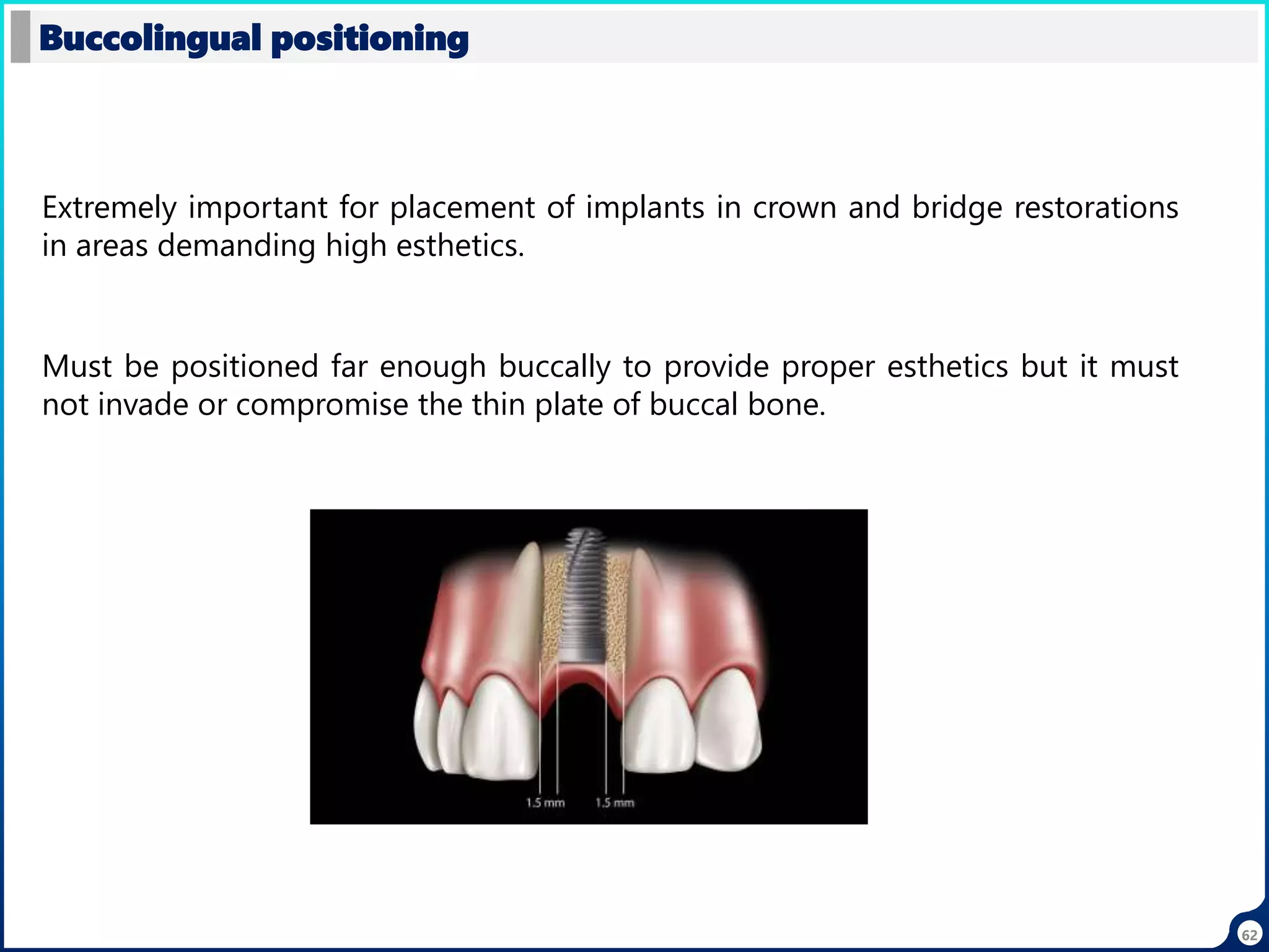 62
Buccolingual positioning
Extremely important for placement of implants in crown and bridge restorations
in areas demanding high esthetics.
Must be positioned far enough buccally to provide proper esthetics but it must
not invade or compromise the thin plate of buccal bone.
 