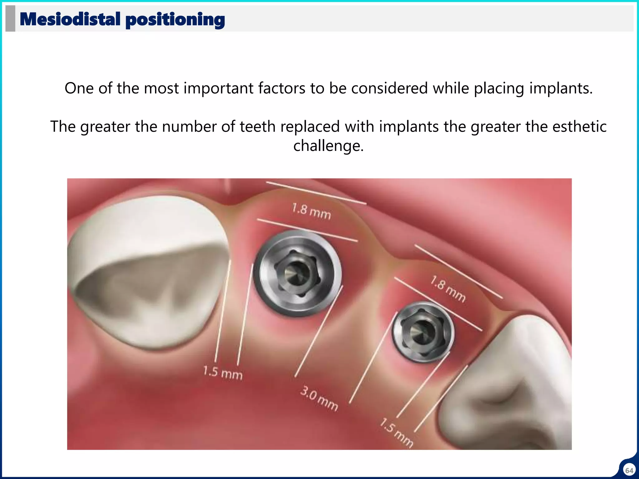 64
Mesiodistal positioning
One of the most important factors to be considered while placing implants.
The greater the number of teeth replaced with implants the greater the esthetic
challenge.
 