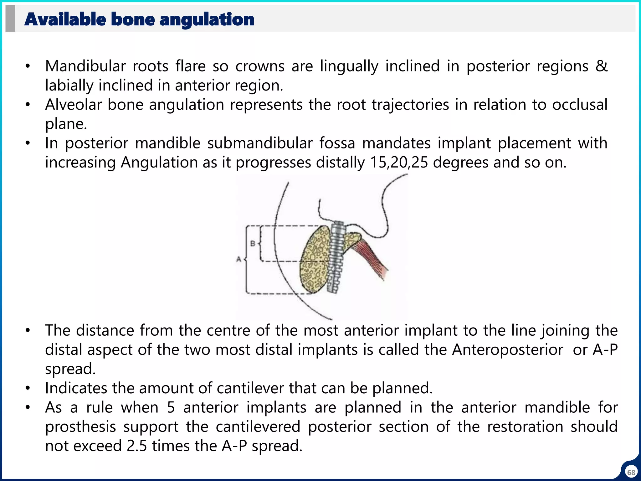 68
Available bone angulation
• Mandibular roots flare so crowns are lingually inclined in posterior regions &
labially inclined in anterior region.
• Alveolar bone angulation represents the root trajectories in relation to occlusal
plane.
• In posterior mandible submandibular fossa mandates implant placement with
increasing Angulation as it progresses distally 15,20,25 degrees and so on.
• The distance from the centre of the most anterior implant to the line joining the
distal aspect of the two most distal implants is called the Anteroposterior or A-P
spread.
• Indicates the amount of cantilever that can be planned.
• As a rule when 5 anterior implants are planned in the anterior mandible for
prosthesis support the cantilevered posterior section of the restoration should
not exceed 2.5 times the A-P spread.
 