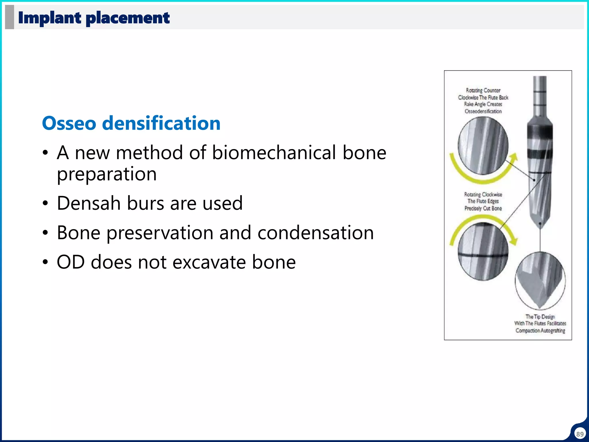 Osseo densification
• A new method of biomechanical bone
preparation
• Densah burs are used
• Bone preservation and condensation
• OD does not excavate bone
Implant placement
89
 