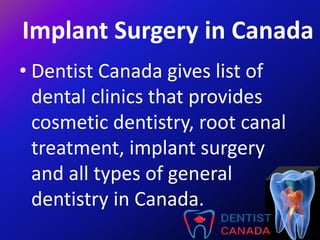 Implant Surgery in Canada
• Dentist Canada gives list of
dental clinics that provides
cosmetic dentistry, root canal
treatment, implant surgery
and all types of general
dentistry in Canada.
 