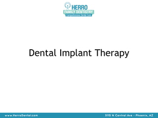 Dental Implant Therapy 