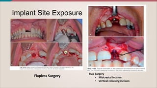 IMPLANT TREATMENT: basic concepts & Techniques.pdf