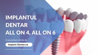 IMPLANTUL
DENTAR
ALL ON 4, ALL ON 6
O prezentare oferita de:
Implant-Dentar.co
 