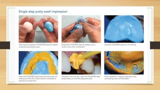 Impression materials | PPTX