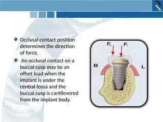 Implant oclussion in dentistry which is useful for a prosthodontist | PPT