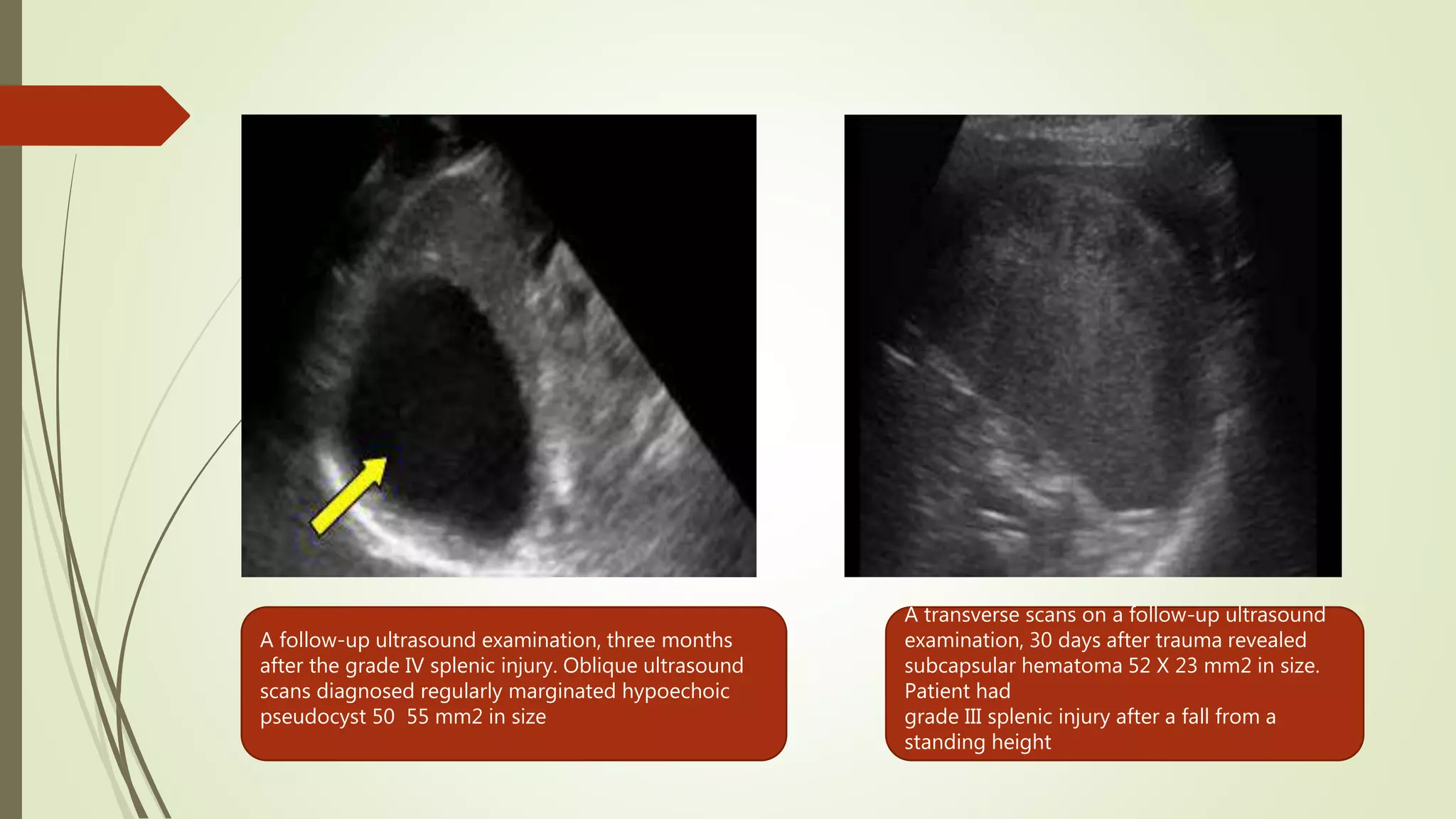 Importance of a follow up ultrasound protocol in monitoring | PPT