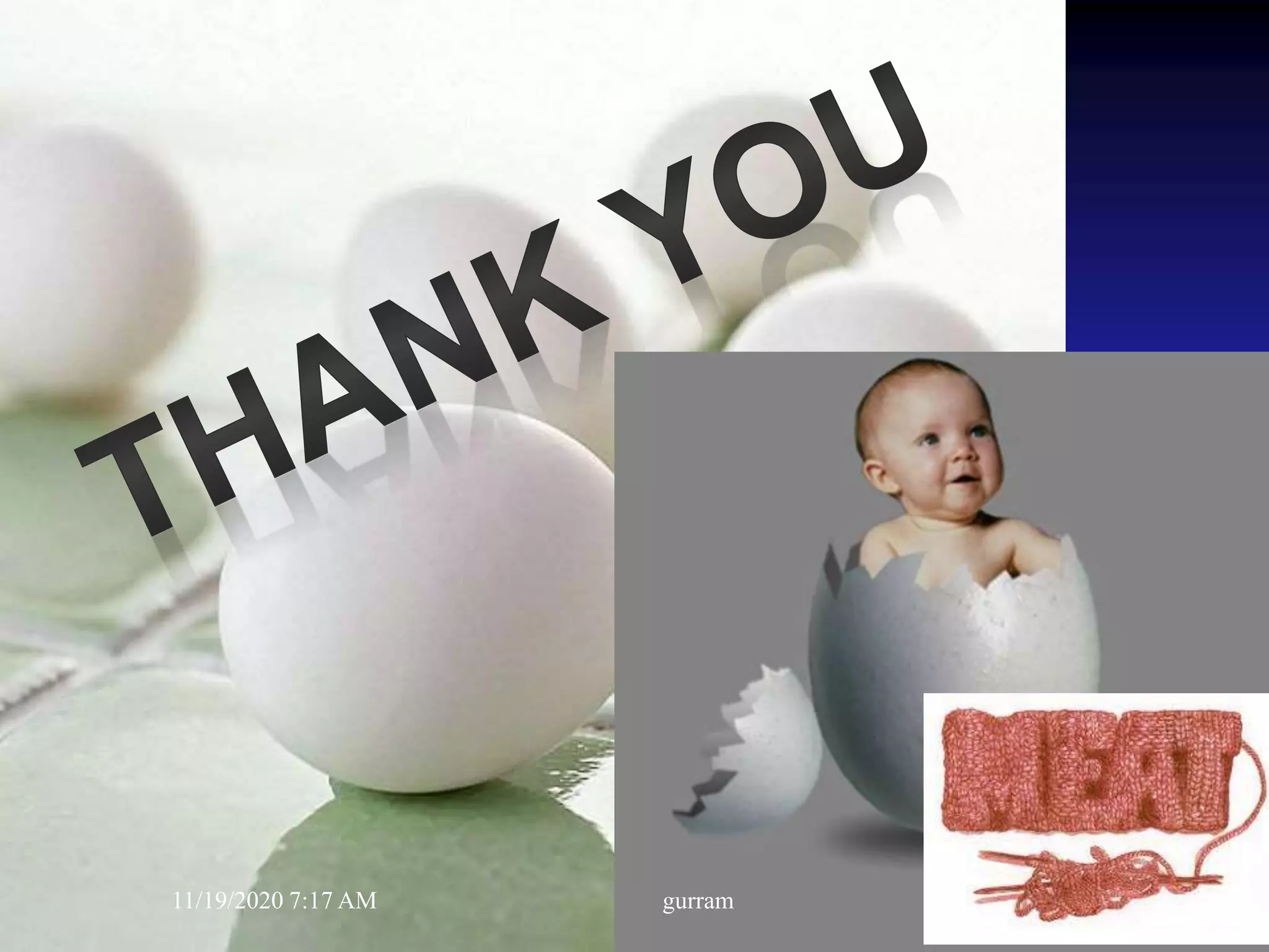 11/19/2020 7:17 AM gurram
 