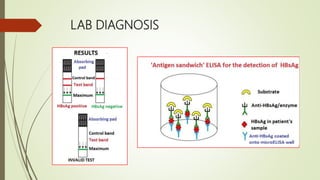 Importance of real time pcr in diagnosis of infectious diseases | PPTX