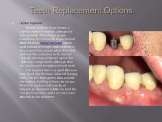  Dental Implants
Dental implants have become a
popular option to replace damaged or
missing teeth. Providing a secure
foundation for removable or permanent
artificial teeth, dental implants can be
used instead of bridges and dentures or
as a support for a dental plate. They feel
and look like your own teeth, and are
typically the most preferred option for
replacing a single tooth, although they
can also be used to replace several teeth.
The implant itself is a small titanium
post, fixed into the bone socket of missing
teeth. The jaw bone grows back around
the implant, holding it firmly in the jaw.
When the implant and bone have
bonded, an abutment is fitted to hold the
new tooth securely, and a crown is then
attached to the abutment.
 