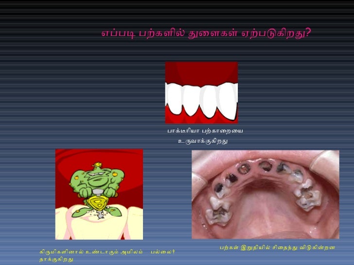 Importance of teeth cleaning in tamil