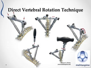 Spine Rod Position Importance of the sagittal profile in spinal deformity surgery | PPTX