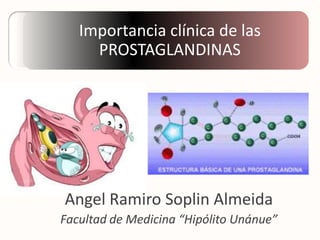 Importancia clínica de las
PROSTAGLANDINAS

Angel Ramiro Soplin Almeida
Facultad de Medicina “Hipólito Unánue”

 