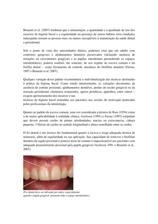 Brunetti et al. (2007) lembram que a alimentação, a quantidade e a qualidade de uso dos
recursos de higiene bucal e a regu...
