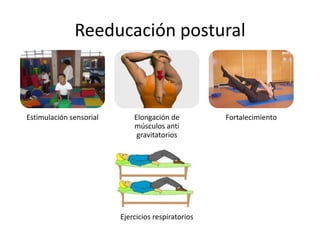 Reeducación postural
Estimulación sensorial Elongación de
músculos anti
gravitatorios
Fortalecimiento
Ejercicios respiratorios
 