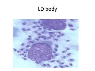 Limf Body Important bodies in pathology | PPTX