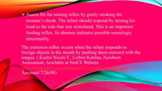  Assess for the rooting reflex by gently stroking the
neonate’s cheek. The infant should respond by turning his
head to the side that was stimulated. This is an important
feeding reflex. Its absence indicates possible neurologic
abnormality.
The extrusion reflex occurs when the infant responds to
foreign objects in the mouth by pushing them outward with the
tongue. ( Keehn Nicole F., Lieben Katrina, Newborn
Assessment, Available at NetCE Website
http://www.netce.com/courseoverview.php?courseid=257,
Accessed 7/26/08)
 