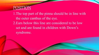 POSITION
1.The top part of the pinna should be in line with
the outer canthus of the eye.
2.Ears below this line are considered to be low
set and are found in children with Down’s
syndrome.
 