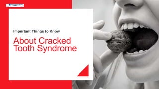 Important Things to Know
About Cracked
Tooth Syndrome
 