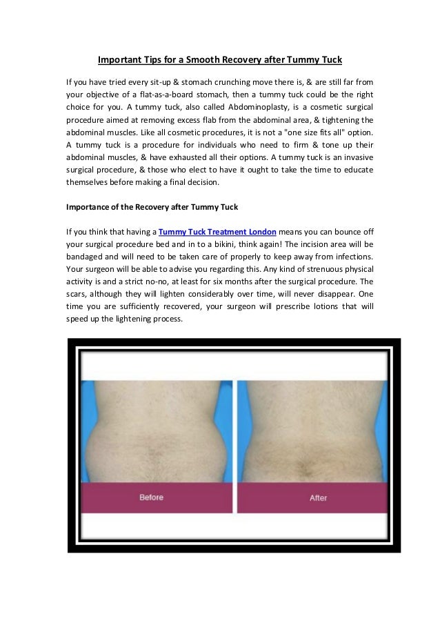 tummy tuck recovery tips and hints tummy tuck recovery tips and hints
