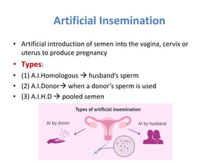 Artificial Insemination
• Artificial introduction of semen into the vagina, cervix or
uterus to produce pregnancy
• Types:
• (1) A.I.Homologous  husband’s sperm
• (2) A.I.Donor when a donor’s sperm is used
• (3) A.I.H.D  pooled semen
 