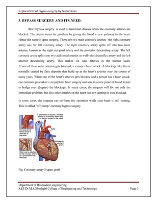 Report on Replacement of Heart bypass surgery by NAnorobots | DOCX