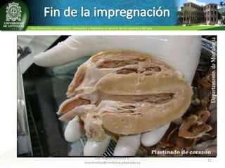 • Esta termina cuando la presión es igual o
menor a 5mmHg y hay ausencia de burbujas.
• Se apaga la bomba, se abren válvulas y se
espera 24 horas antes de retirar los
componentes de la cámara de vacío.
• Se tienen componentes anatómicos listos para
un proceso de curado

Luis Miguel Acevedo A.
lmacevedoa@medicina.udea.edu.co

15

 